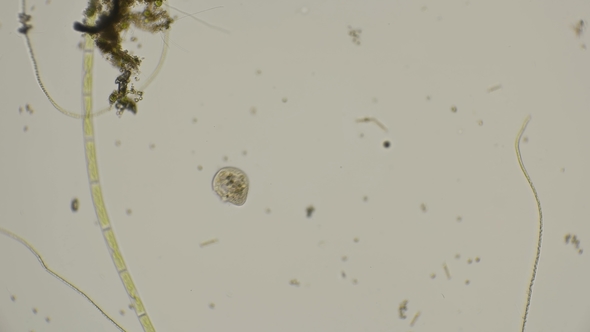 Ciliated Infusoria Under a Microscope