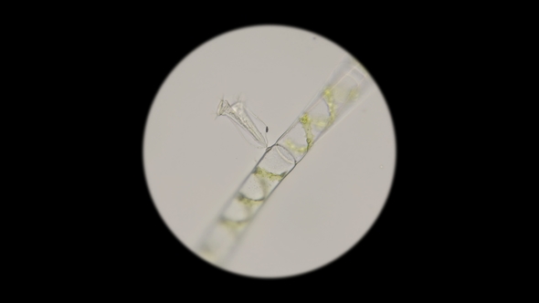 Filamentous Algae Spirogrya Under the Microscope