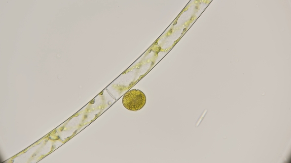 Filamentous Algae Spirogrya Under the Microscope