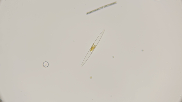 Diatom Algae in Fresh Water, Under a Microscope