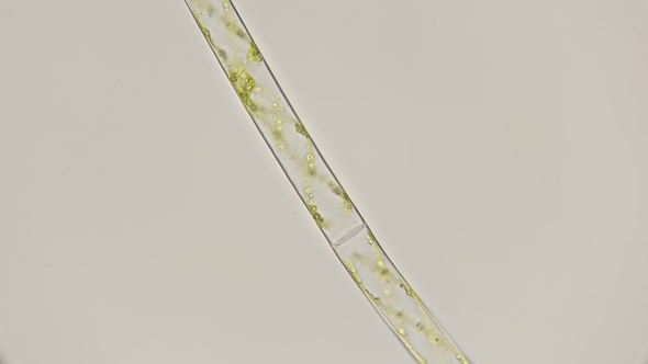Filamentous Algae Spirogrya Under the Microscope