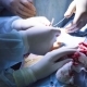 The Surgeon Making an Incision on the Abdomen - VideoHive Item for Sale