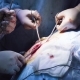 Hands of the Two Surgeons During Suturing - VideoHive Item for Sale