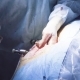 The Surgeon Making an Incision on the Abdomen - VideoHive Item for Sale