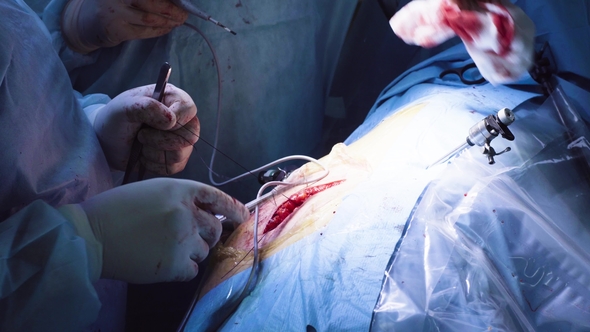 Hands of the Two Surgeons During Suturing