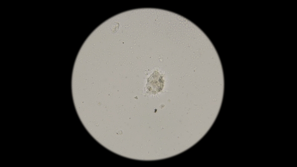 Accelerated Movement of Amoebae Under the Microscope