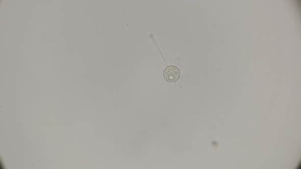 Infusoria Podophrya Under a Microscope