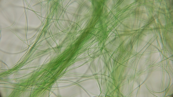 Movement of Live Algae Under a Microscope, Similar To the Tentacles of the Body, Which Is Very