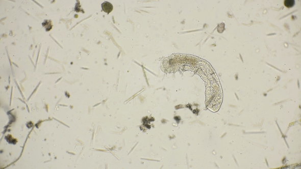 The Simplest Microorganism Worm under a Microscope