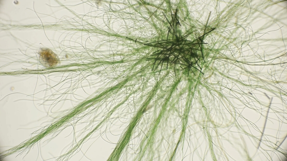 Movement of Live Algae Under a Microscope, Similar To the Tentacles of the Body, Which Is Very