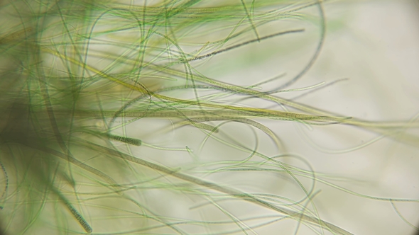 Movement of Living Algae Under a Microscope