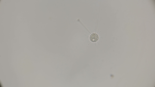 Infusoria Podophrya Under a Microscope