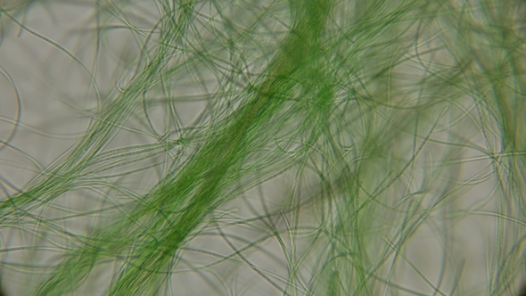 Movement of Live Algae Under a Microscope, Similar To the Tentacles of the Body, Which Is Very