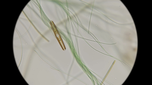 the Movement of Diatom Alga Among Ordinary Live Algae Under a Microscope