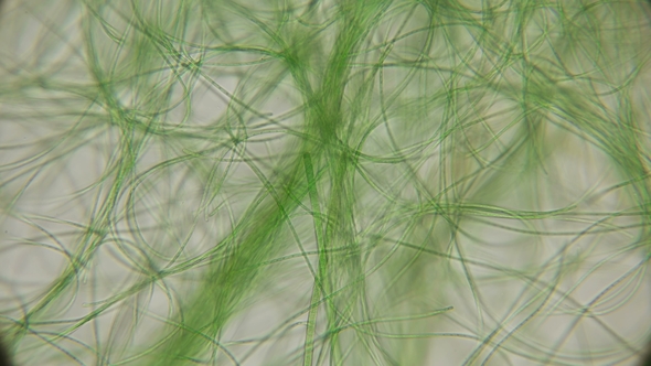 Movement of Live Algae Under a Microscope, Similar To the Tentacles of the Body, Which Is Very