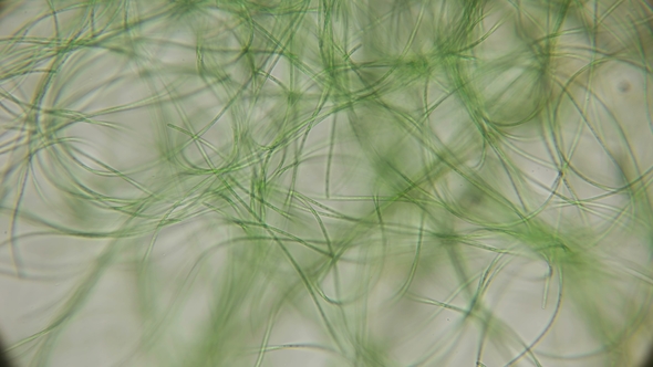 Movement of Living Algae Under a Microscope