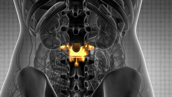 Backache in Back Bones alt