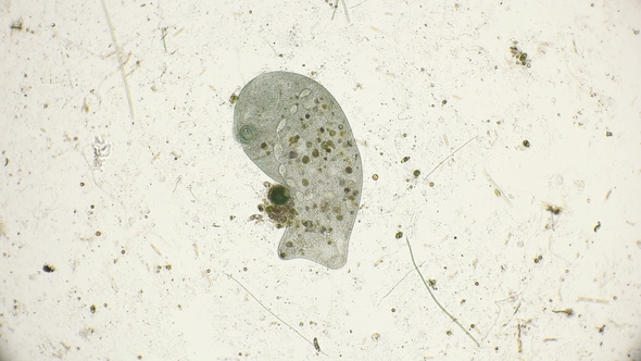Infusoria Stentor Coeruleus Under the Microscope