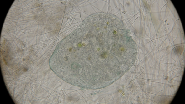 Infusoria Stentor Coeruleus Under the Microscope