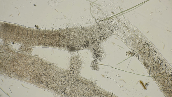 a Colony of Microorganisms That Multiplies and Consumes Worm Remains Under a Microscope