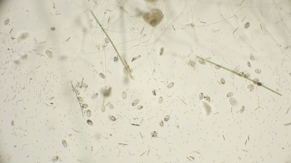 Colony Infusoria Shoe Under a Microscope