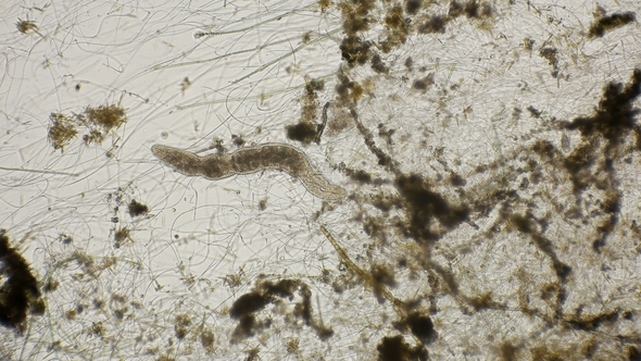 Movement of the Worm Oligochaet Under the Microscope