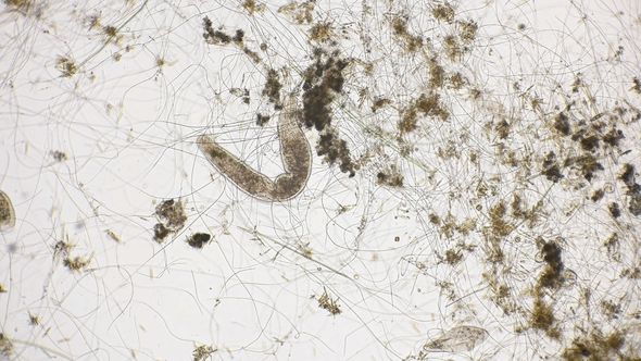 Movement of the Worm Oligochaet Under the Microscope