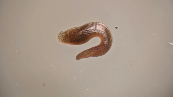 Leech Under the Microscope Winds