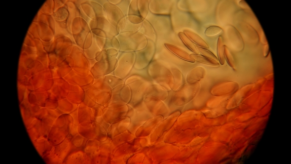 Frog Blood Under a Microscope