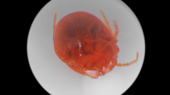 Water mite-Hydrachnidia Under a Microscope