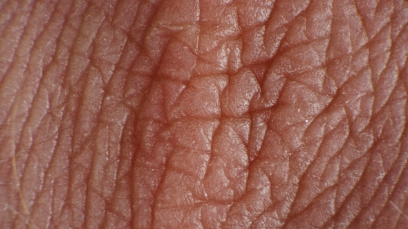 Wrinkled and Cracked Human Skin Under a Microscope