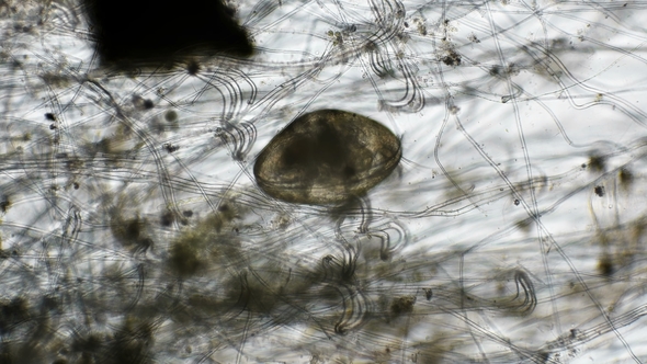 Shellfish Crustaceans Ostracoda Under a Microscope alt