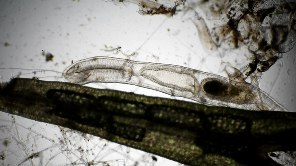 Worm Oligochaet Under the Microscope