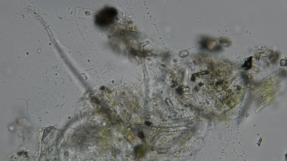 a Dirty Drop of Water with a Rod-shaped Bacterium and Spirochaete Under a Microscope alt