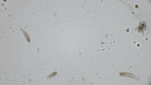 a Drop of Water From a Pond with a Variety of Microorganisms Including Nauplius Cyclops Under a alt