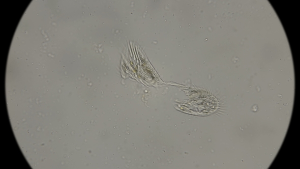 Wrong Development Infusoria Shoe Under a Microscope