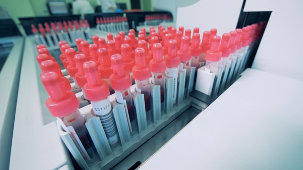 Many Bottles with Blood, . Special Machine Tests Blood Samples in Tubes at a Clinic. alt