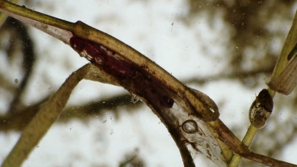 The Larva of a Mosquito Makes a Cocoon in a Pond, Under a Microscope