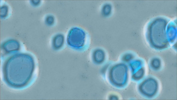 Microscopic Slow Bubbles