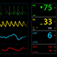 EKG Monitor Screen - VideoHive Item for Sale