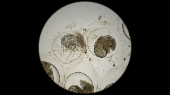 Eggs of Planorbis Snails with Already Developed Embryo and Dead Eggs, Infected with Infusoria