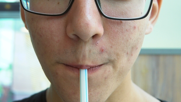 A Young Man with Acne on His Face Drinks Soda From the Straw