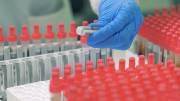 Laboratory Worker Checks Tubes Before Placing Them on a Rack alt