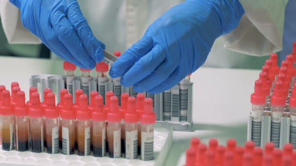 A Nurse Checks the Quality of Tubes alt