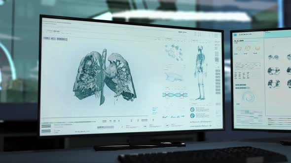 Advanced Analysis Of Lung Cancer In Futuristic Organ Scanner Interface