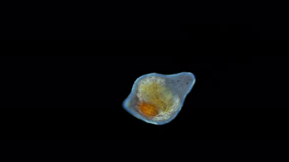 A worm (flatworm) of the Dalyelliidae family under a microscope, Rhabdocoela Order