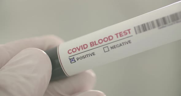  Positive Covid Blood Test Result