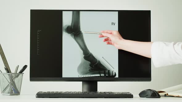 Doctor Veterinarian Examining Horse Leg Skeleton Roentgen on Computer Monitor