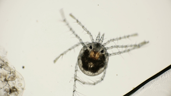 Water Mite Moving Legs Under a Microscope