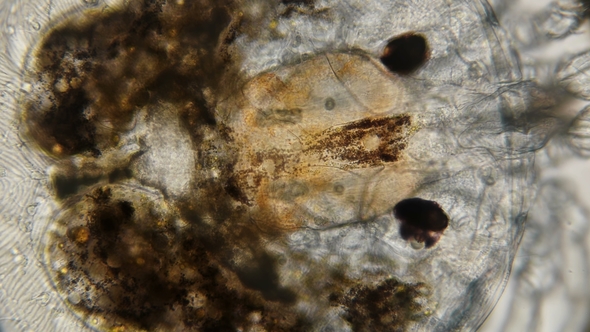 the Internal Organs of the Water Mite, Under a Microscope